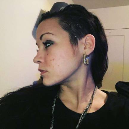 Epilepsy survivor crusades for victims Tania Fonovic shows off her post inter-cranial EEG staples to motivate others to not shyaway from being proud of who they are