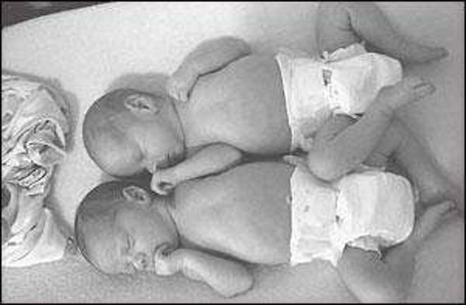 Twin grandchildren for Newton resident Twin grandchildren for Newton resident